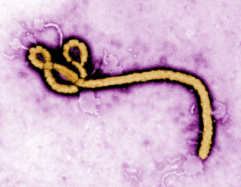 Ebola na mikroskopickém snímku. Ebola na mikroskopickém snímku.