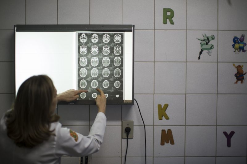 Brazilská doktorka Angela Rochaová ukazuje rentgenové snímky mozku dítěte narozeného s mikrocefalií (nedostatečně vyvinutou hlavou). Za hlavní příčinu onemocnění je označován virus zika.