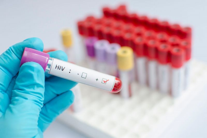Německá organizace na pomoc lidem nakaženým virem HIV Deutsche AIDS-Hilfe vyzvala českou vládu, aby zastavila stíhání 30 HIV pozitivních mužů. 