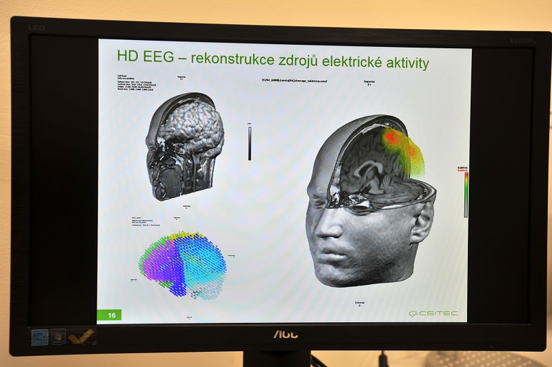 Na přednáškách se zájemci dozvědí o nejnovějších novinkách ve výzkumu mozku.