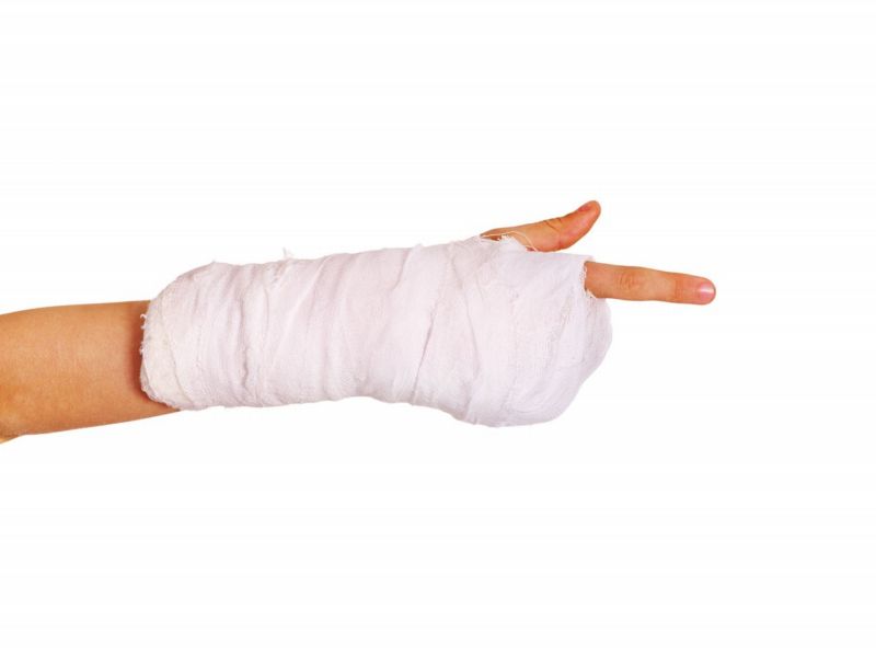 Žena od nemocnice vysoudila peníze za nezdařenou operaci ruky až po osmi letech od zákroku. Žena od nemocnice vysoudila peníze za nezdařenou operaci ruky až po osmi letech od zákroku.