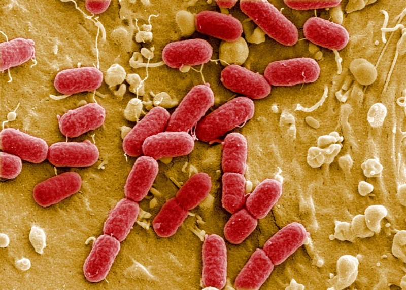 Střevní bakterie Escherichia coli.