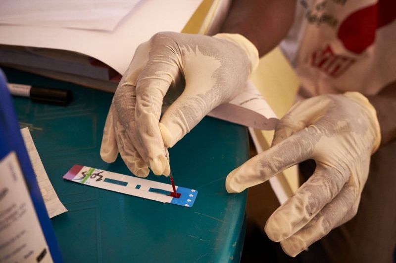 AIDS je podle Lékařů bez hranic nejlepším příkladem úspěšného boje s globální chorobou.