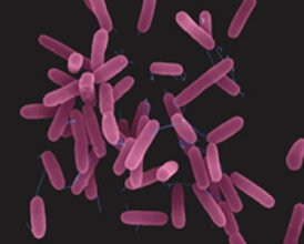 Pseudomonas aeruginosa na počítačem dobarveném snímku z elektronového mikroskopu.