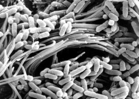 P. aeruginosa v lidském dýchacím traktu.