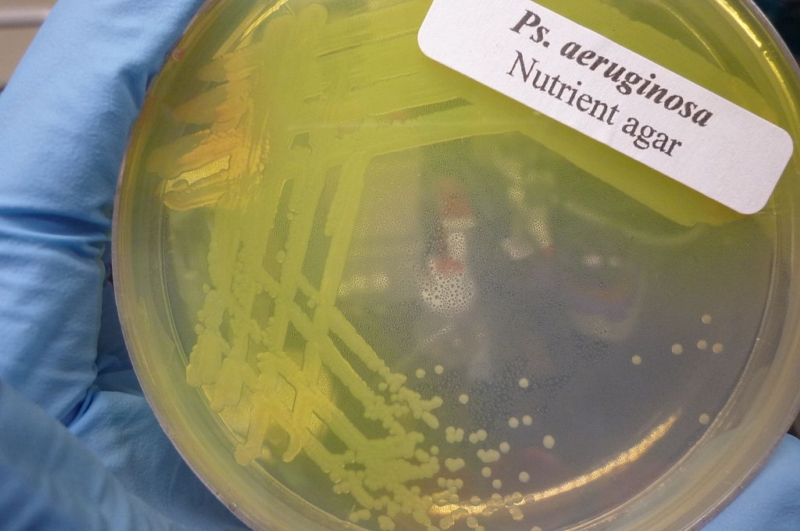 Kultura bakterie Pseudomonas aeruginosa na Petriho misce.