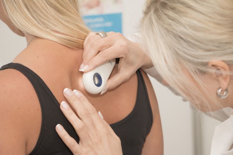 Vyšetření ručním dermatoskopem. Vyšetření ručním dermatoskopem.