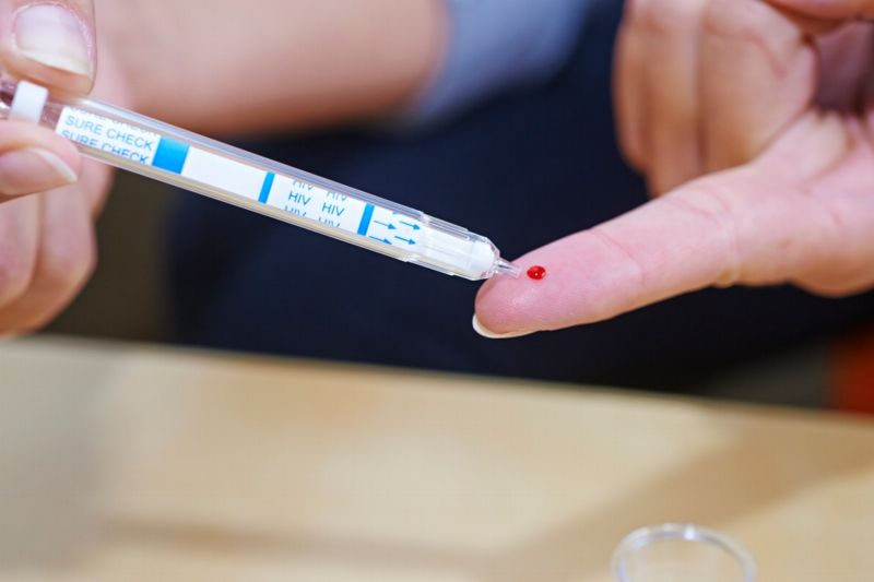 Počty nakažených virem HIV každoročně přibývá. Počty nakažených virem HIV každoročně přibývá.