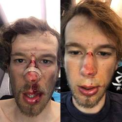 Český cyklista Leopold König se při závodu zranil.