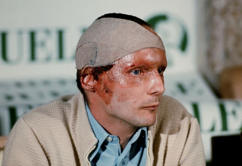 Niki Lauda na tiskové konferenci po svém zranění a před návratem do monopostu.