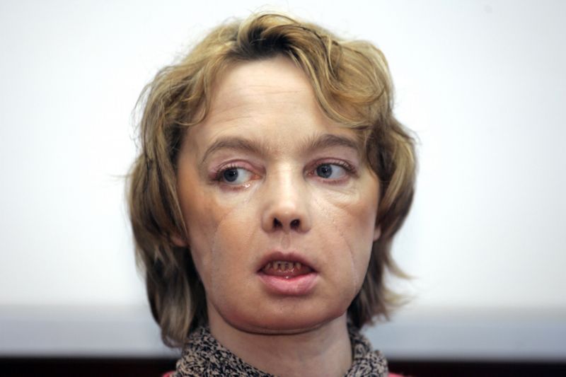 Francouzka Isabelle Dinoireová. Francouzka Isabelle Dinoireová.
