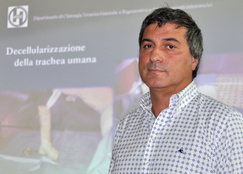 Chirurg Paolo Macchiarini je podezřelý z falšování lékařských záznamů a neúmyslného zabití dvou svých pacientů. Chirurg Paolo Macchiarini je podezřelý z falšování lékařských záznamů a neúmyslného zabití dvou svých pacientů.