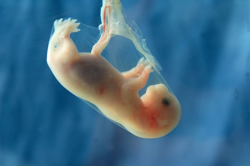 Lidské embryo.