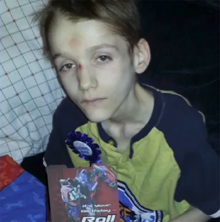 Vyhladovělého Alexe nechali bezcitní rodiče zemřít.