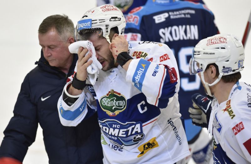 Leoš Čermák má na zranění v obličeji smůlu. Leoš Čermák má na zranění v obličeji smůlu.