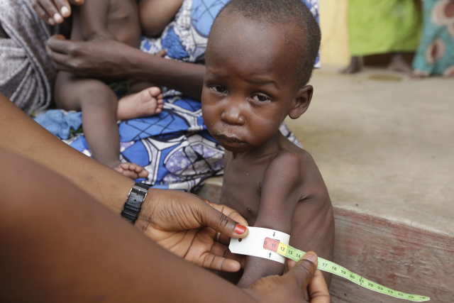 Lékařka ošetřuje podvyživené dítě v nigerijském uprchlickém táboře v Yola.