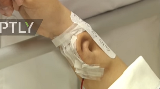 Ucho bylo vypěstováno na předloktí pacienta.