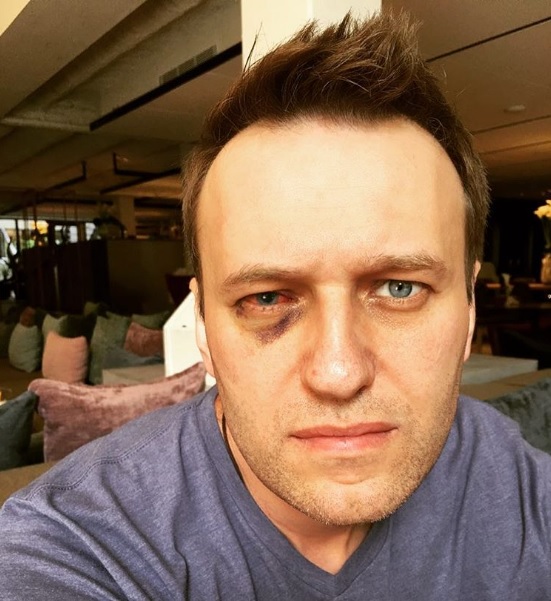 Ruský opoziční vůdce Alexej Navalnyj. Ruský opoziční vůdce Alexej Navalnyj.
