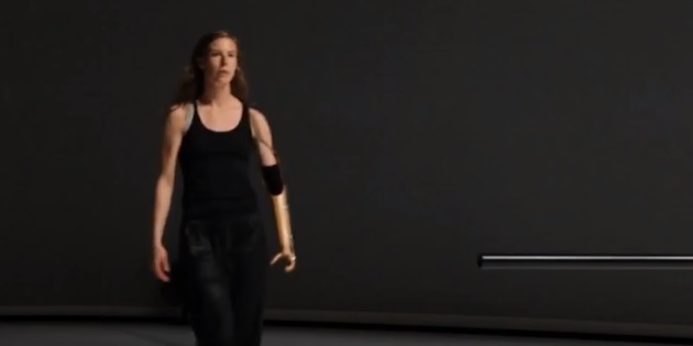 Britská tanečnice Annie Hanauerová, která má protézu ruky.