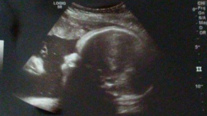V levé části obrázku je podle páru vidět postava Ježíše Krista. 