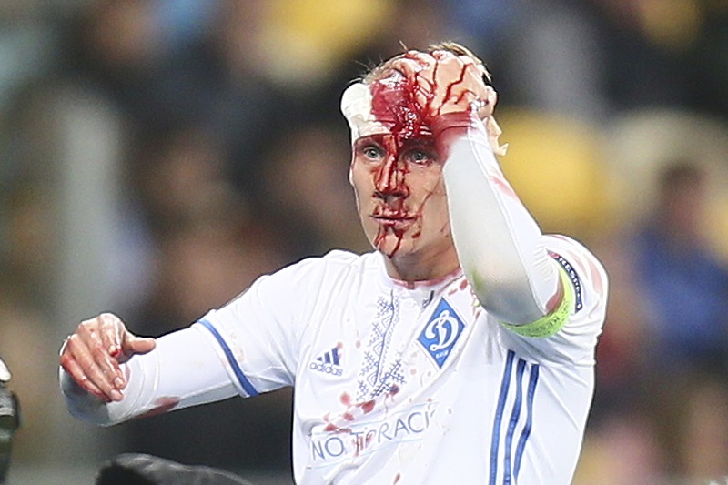 Domagoj Vida.