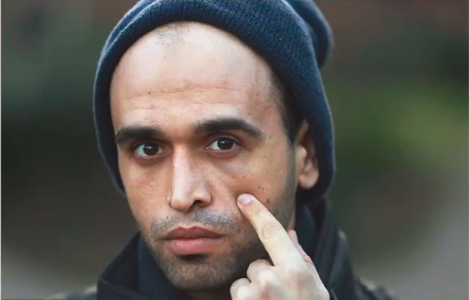 Napadený palestinský student Ihsan Abualrob.