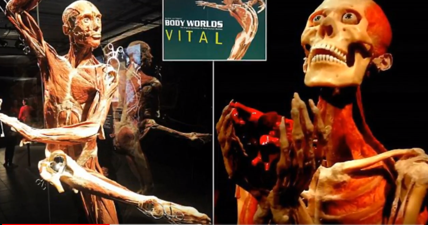 Výstava Body Worlds Vital na Novém Zélandu. Výstava Body Worlds Vital na Novém Zélandu.