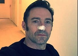 Problémy s nádory v obličeji má hollywoodský herec Hugh Jackman. Na slunci nepoužíval ochranné krémy.