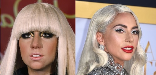 Lady Gaga.