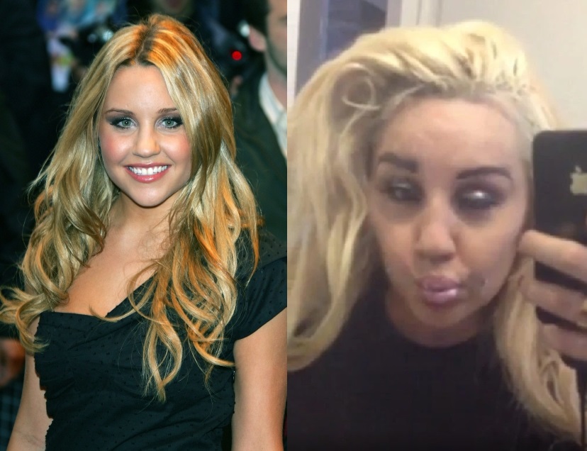 Amanda Bynes