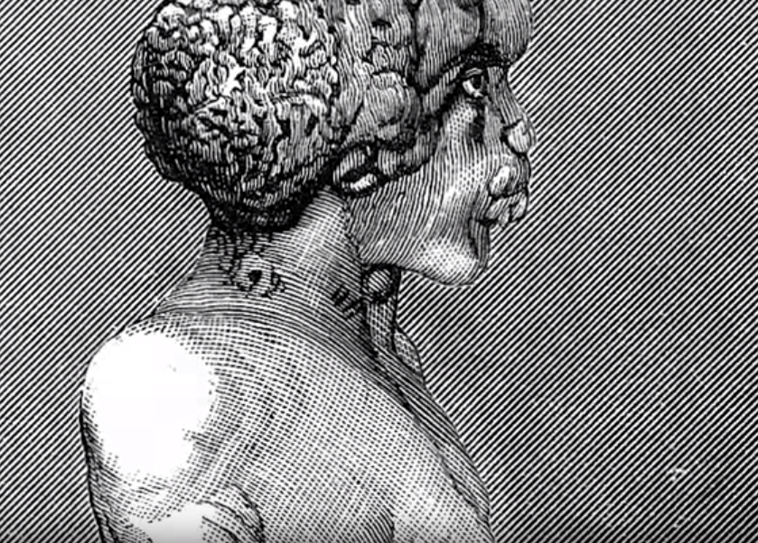 "Sloní muž" Joseph Merrick.