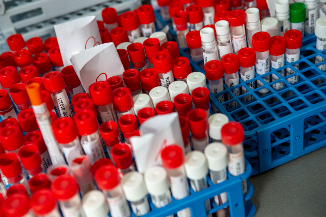 Laboratoř na testování covid-19.
