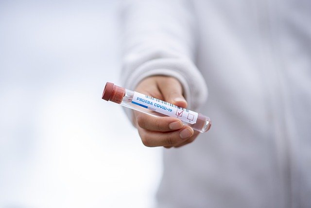 Co nás naučil koronavirus?