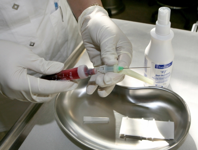 Test HIV.