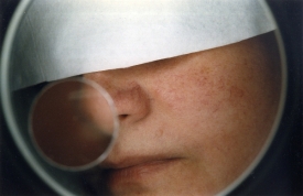 Prvenství v transplantaci obličeje si v roce 2005 připsali Francouzi.