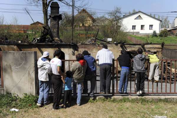 Otec popálené dívky je nyní ve vězeňské nemocnici na Pankráci.
