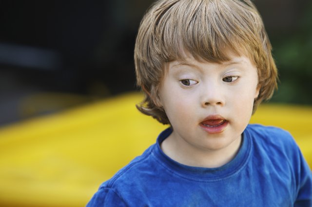 Školy trvdí, že neumí dítě s Downovým syndromem začlenit.