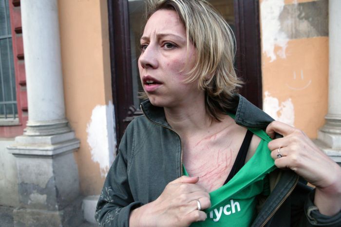 Kateřina Jacques bezprostředně po incidentu 1. května 2006.
