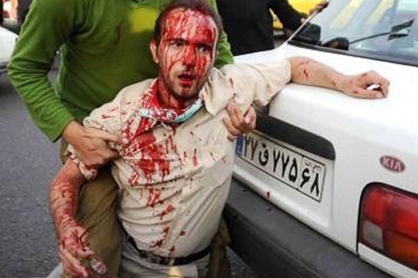 Zraněný muž ze sobotní demonstrace v Teheránu.