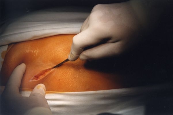 Chirurgie, interna a JIP nesmí zaniknout, žádají zastupitelé. Chirurgie, interna a JIP nesmí zaniknout, žádají zastupitelé.