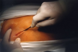 Chirurgie, interna a JIP nesm&iacute; zaniknout, ž&aacute;daj&iacute; zastupitel&eacute;.