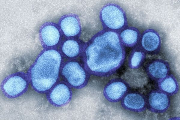 Geny nebezpečných virů mezi lidmi kolují roky před pandemií. Geny nebezpečných virů mezi lidmi kolují roky před pandemií.