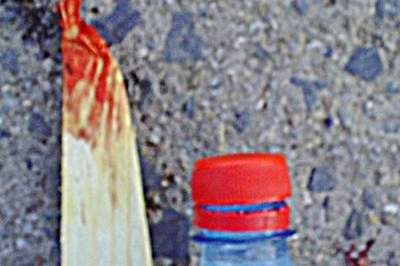Tříska způsobila půlcentimetrovou ránu v srdeční komoře. Tříska způsobila půlcentimetrovou ránu v srdeční komoře.