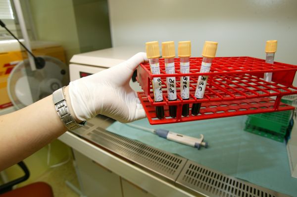 Milion vakcín možná vystačí pro milion nakažených. Milion vakcín možná vystačí pro milion nakažených.