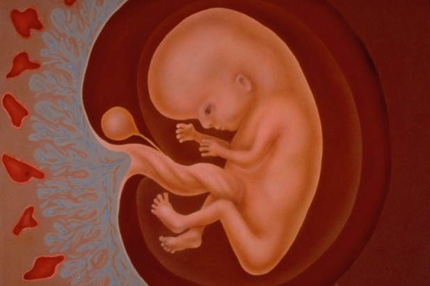 Plod v děloze (grafika).