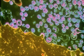 Namnožen&eacute; viry HIV opou&scaron;těj&iacute; buňku, brzy za&uacute;toč&iacute; na dal&scaron;&iacute;.