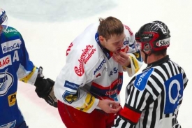 Českobudějovický Tůma ukazuje rozhodčímu Minářovi své zranění. Českobudějovický Tůma ukazuje rozhodčímu Minářovi své zranění.