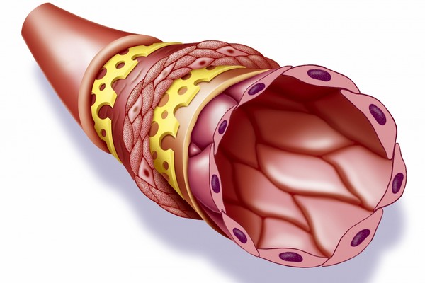 Normální cévy mají složitou anatomii, ty umělé se je snaží napodobit.