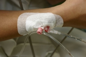 Žena vytáhla pacientovi z ruky kanylu, která ho držela při životě.