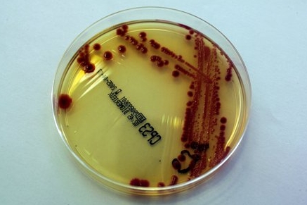 Bakterie Escherichia Coli Bakterie Escherichia Coli